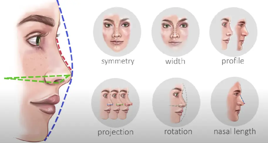 PROCEDURE OF THE WEEK: Nasal Surgery (Rhinoplasty)