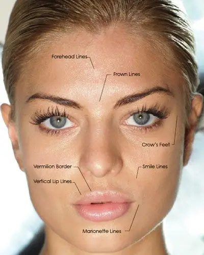 Botox applicable face sections