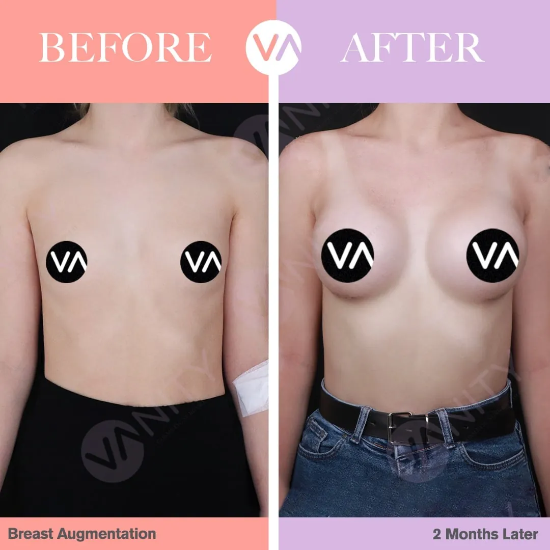 Boobs before and sales after working out