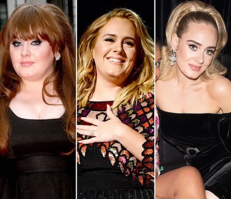 Adele Before and After Plastic Surgery and Weight Loss