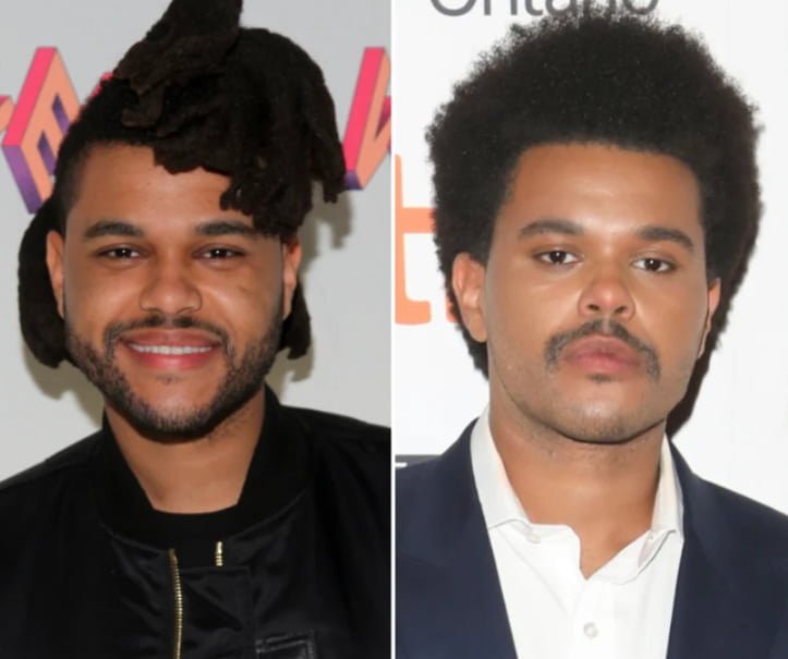 Collection 91+ Pictures The Weeknd Before Plastic Surgery Photos Superb ...