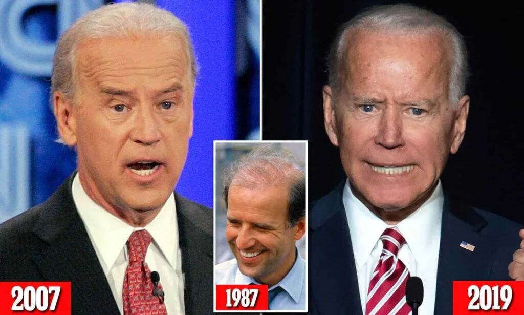 Joe Biden Before and After