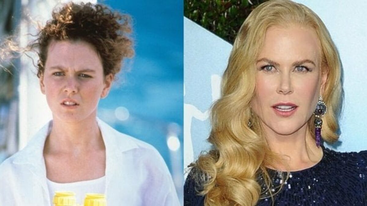 Nicole Kidman's Plastic Surgery | Before and After - Vanity