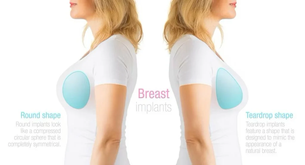 Which Breast Aesthetics Technique Is Right For You?