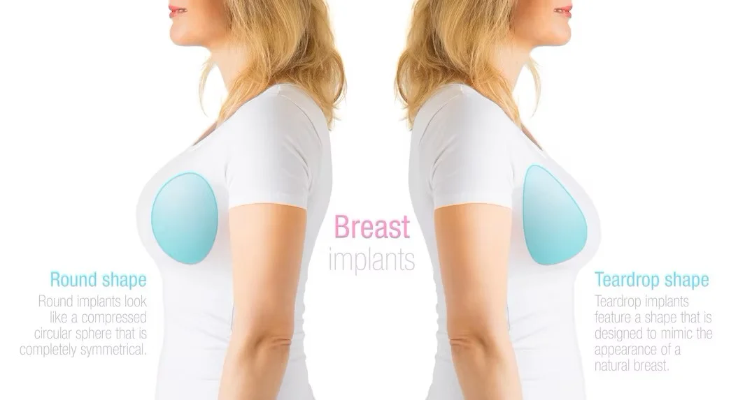 Which Breast Aesthetics for You? - Vanity