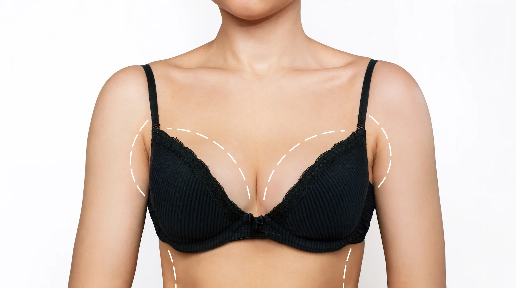 What Are Pointy Breasts or Puffy Nipples? - Anca Breahna Plastic Surgeon